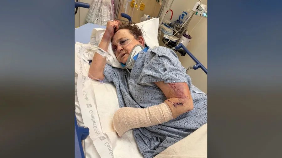 Grandmother beaten with baseball bat by man she helped