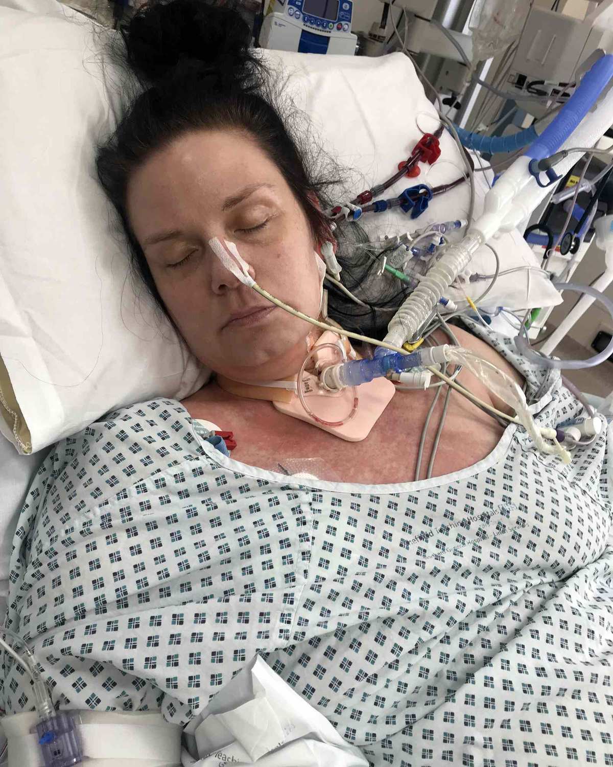 Mom of 2 Thought She Had a ‘Nasty Cold.’ Hours Later, She Was Fighting for Her Life