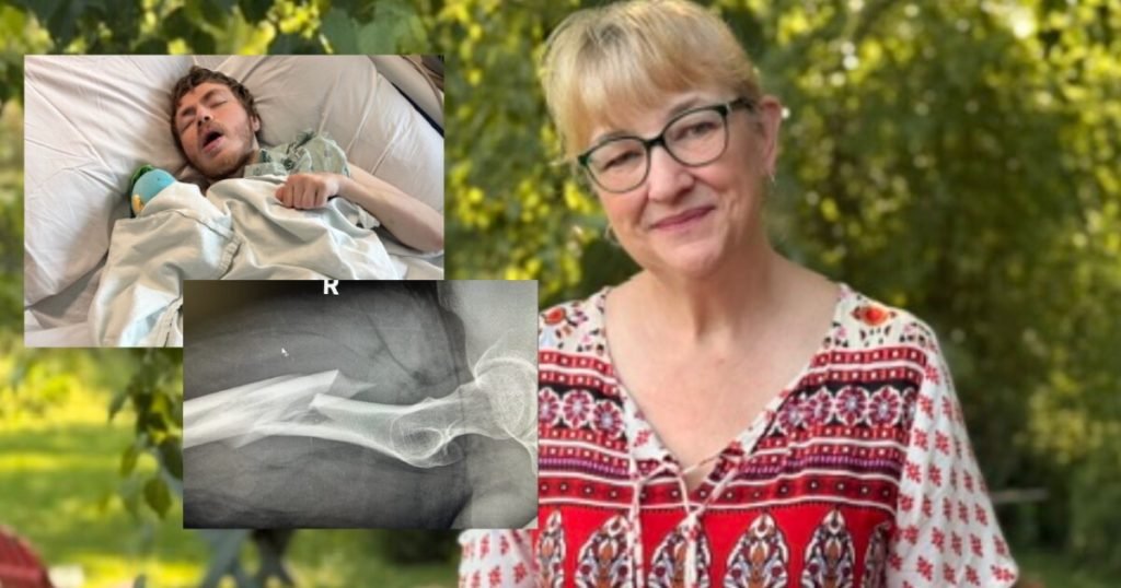 Caretaker arrested after disabled man’s leg broken