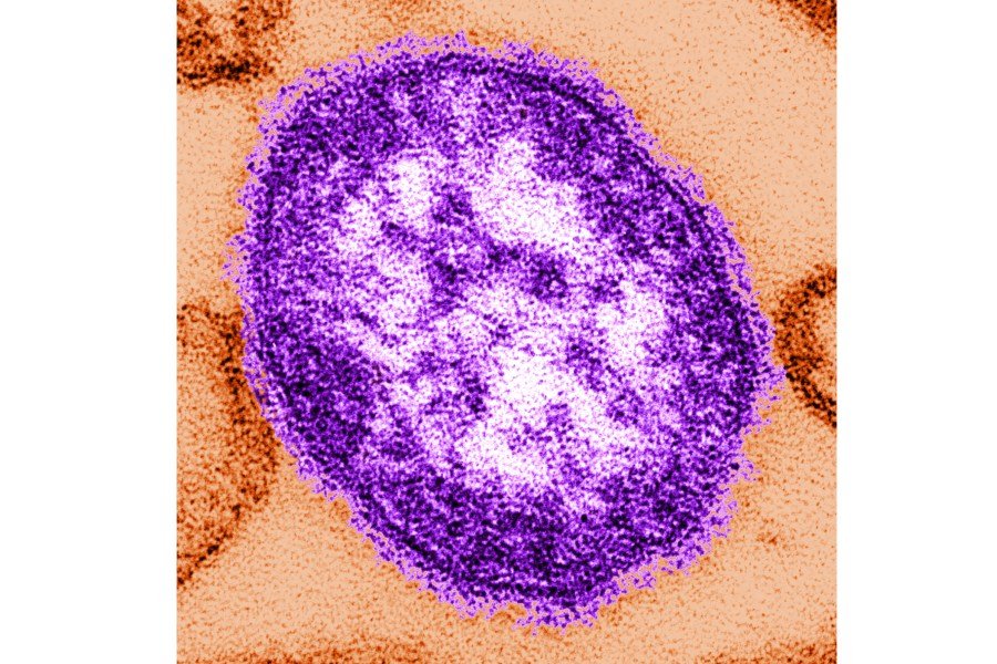 Pennsylvania reports 6th measles death