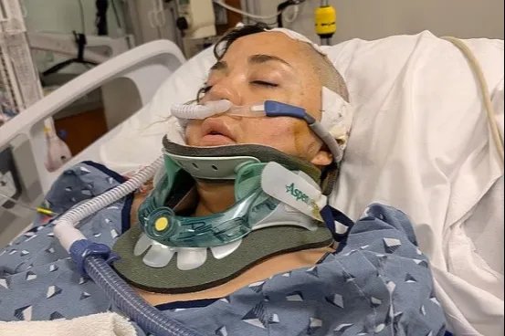Two women brain damaged on Six Flags ride—why?