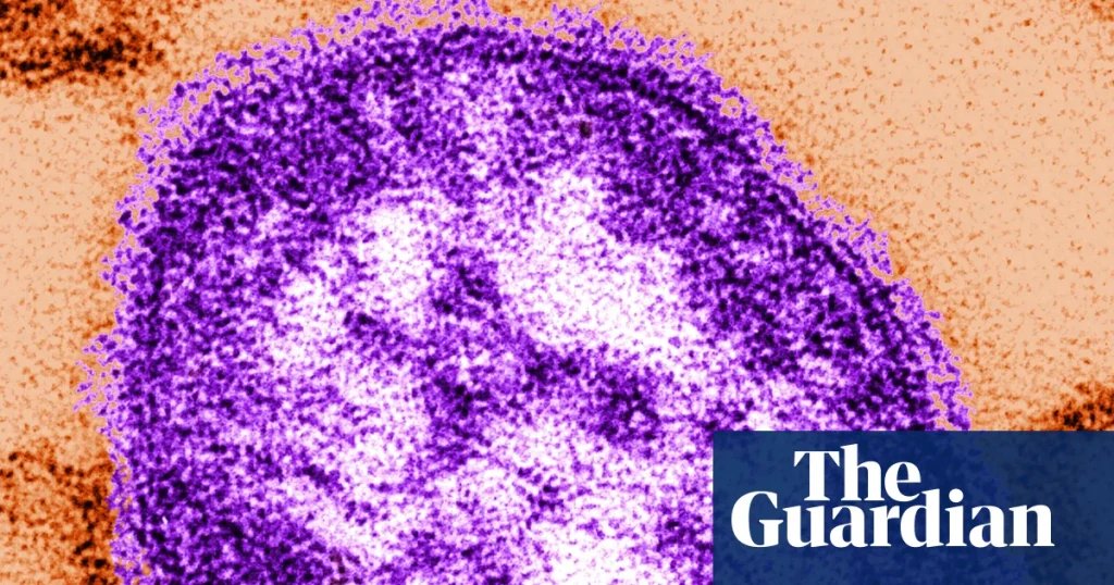 Infant dies from measles in Pennsylvania outbreak