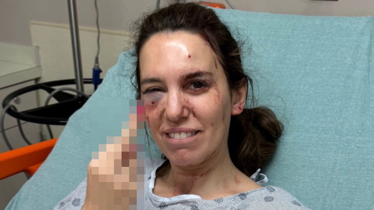 Christy Carlson Romano’s face is bloodied and battered after being shot in shocking never-before-seen hospital photos